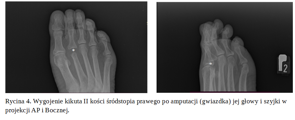 Zrzut ekranu (32)