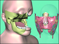 Face transplantation: challenges for the surgeon