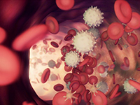COVID-19 infection mimicking acute promyelocytic leukemia